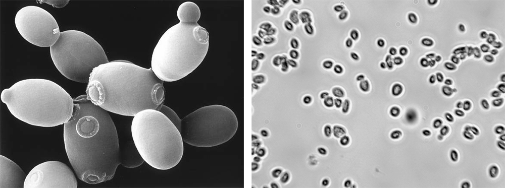 Saccharomyces cerevisiae